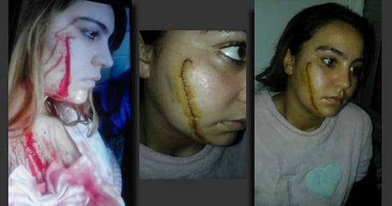 وأخيرا الناشط المعطي منجب المضرب عن الطعام ينقل إلى المستشفى