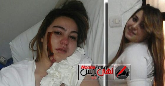 زوج يشوه وجه زوجته بآلة حادة