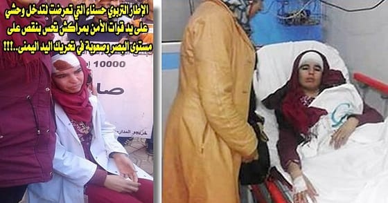 6 إصابـات وحالات جد حرجـة في صفــوف ” 10 آلاف إطــار”بمراكـش بعد تدخـل أمنـي لفض اعتصامهــم بجامع لفنـــا